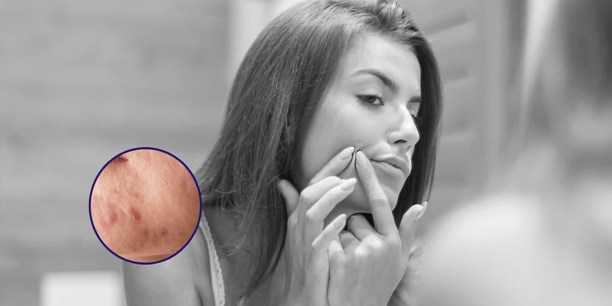 Pflegeempfehlungen bei Pigmentflecken