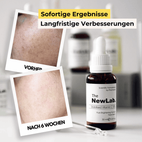 Serum gegen Pigmentflecken