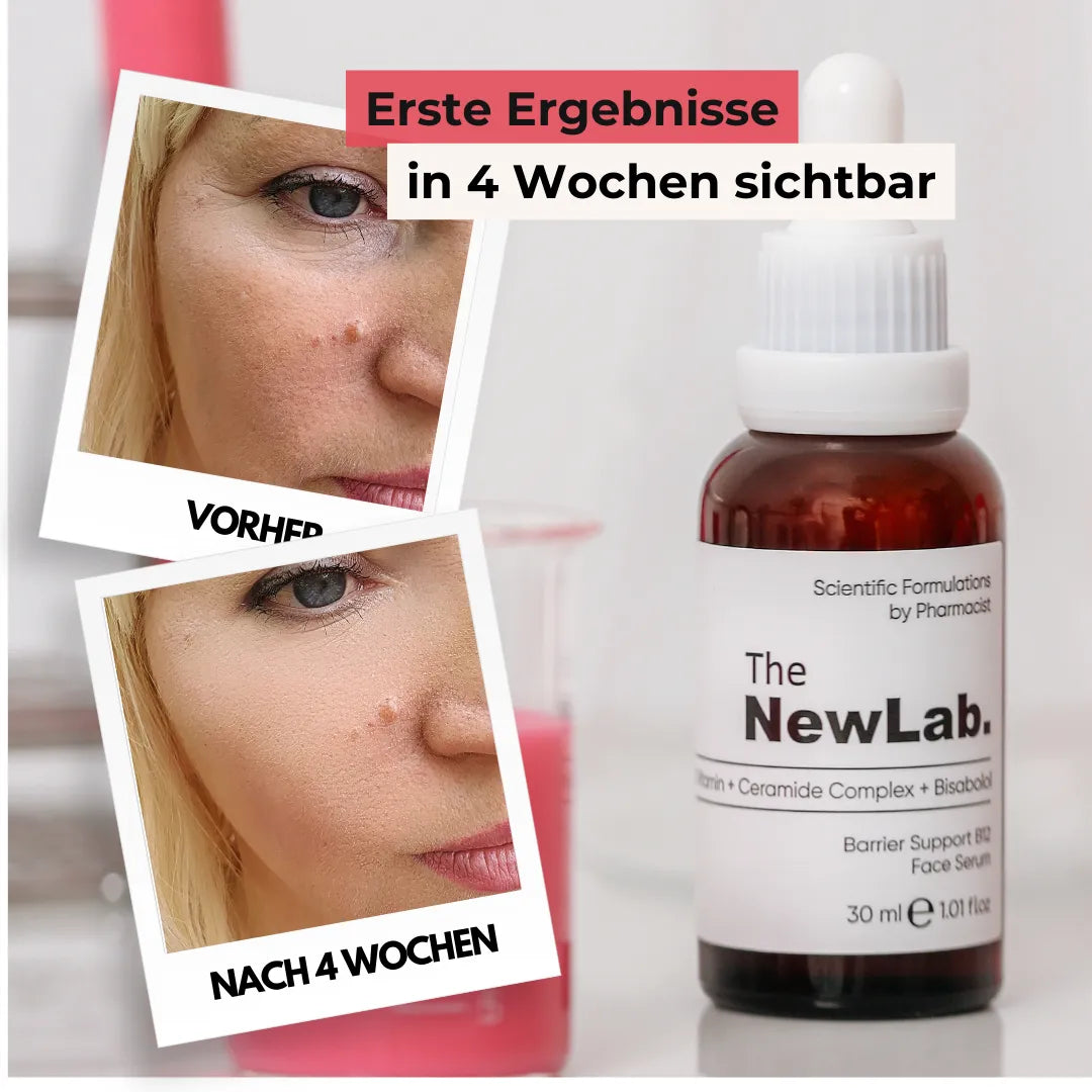 Serum mit Ceramiden